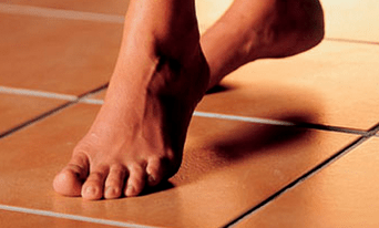 walking barefoot as a cause of the appearance of fungus on the skin of the feet