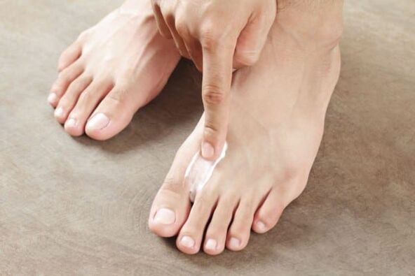 ointment smear of skin fungus on the feet
