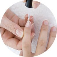 apply nail polish to treat nail fungus
